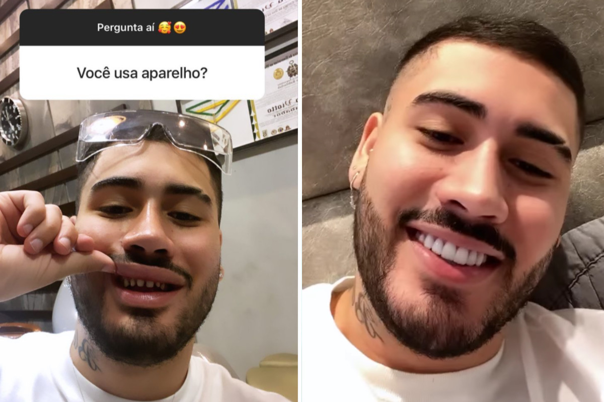 Ao Ser Perguntado Se Usa Aparelho Kevinho Mostra Dentes Sem Lentes De