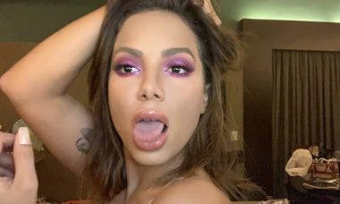 Anitta compartilha clique de topless e brinca com os seguidores: ''Só plásticas''