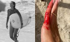 Isabella Fiorentino compartilha machucados depois de dia de surfe