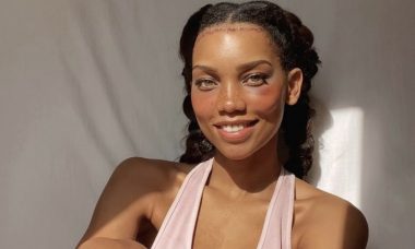 Modelo faz cirurgia para diminuir 3 cm de testa: "Não poderia estar mais feliz"