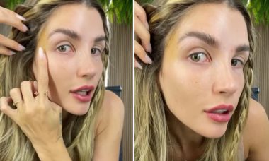 Aline Gotschalg mostra resultado de fox eyes: "Ainda está roxo"