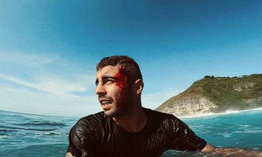 Pedro Scooby mostra pontos na cabeça após se machucar na Indonésia. Foto: Reprodução Instagram