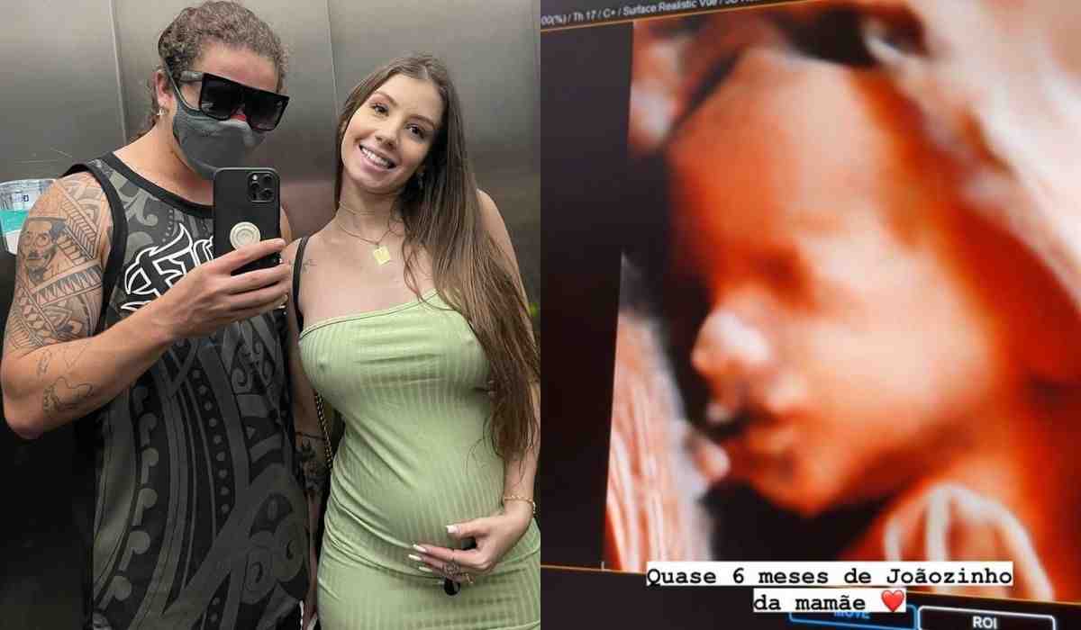 Namorada de Whindersson exibe novo ultrassom com rostinho do bebê