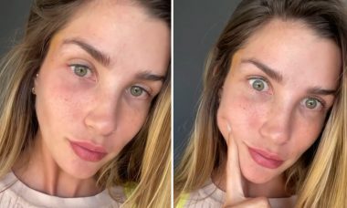 Aline Gotschalg para de usar filtros nas redes sociais: "Não estava me reconhecendo"