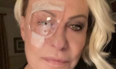 Ana Maria Braga passa por cirurgia no olho: "Pirata moderna"