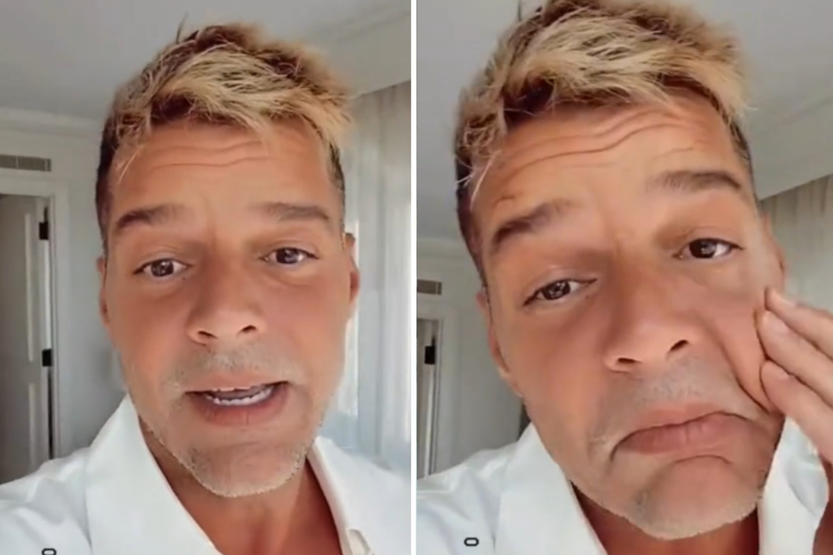Ricky Martin nega harmonização facial após críticas: "Não mexo na cara"
