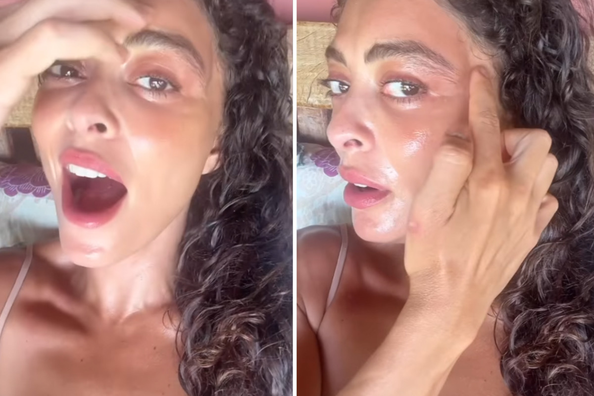 Juliana Paes mostra rosto inchado após picada de inseto: "Preenchimento natural"