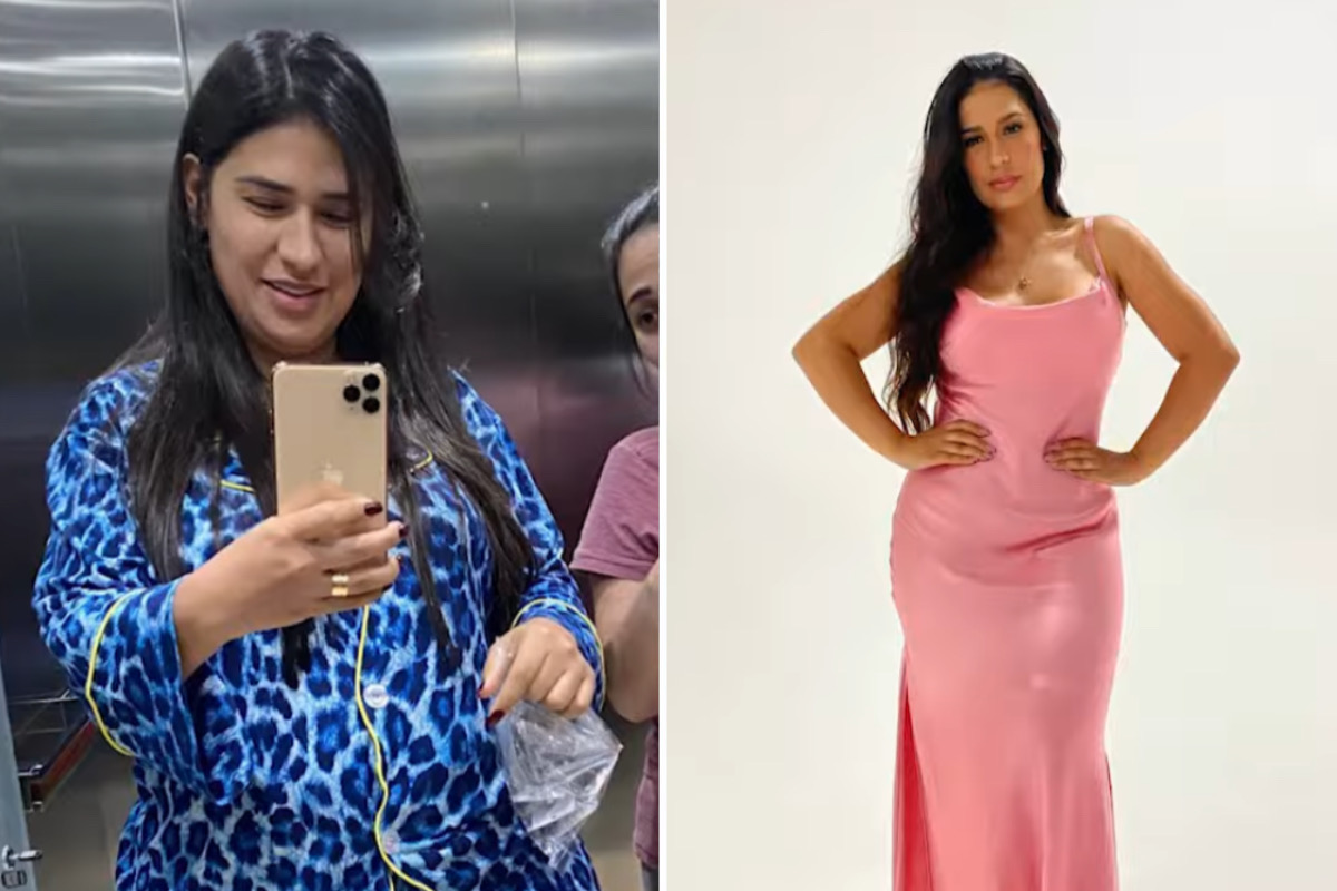 Simone mostra antes e depois de perder 25 kg 