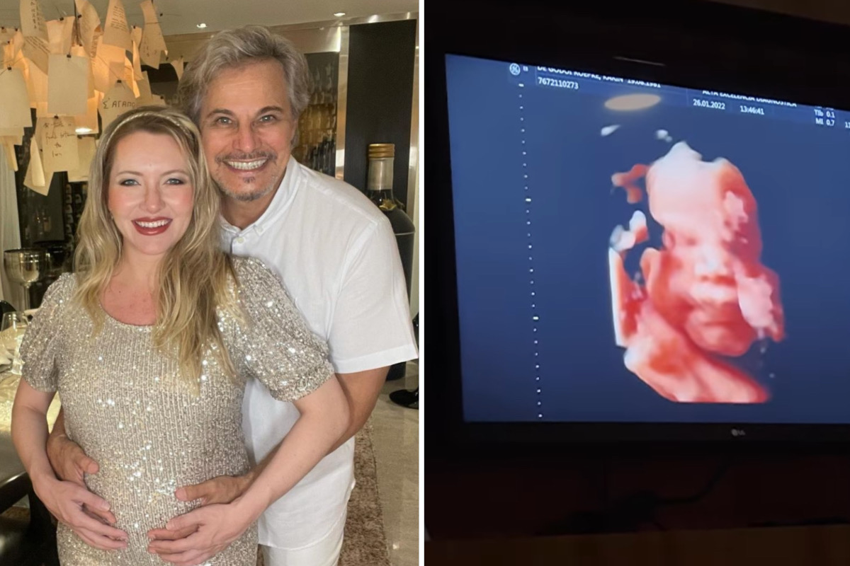 Edson Celulari mostra rostinho da filha em ultrassom 3D: "Garota sapeca"