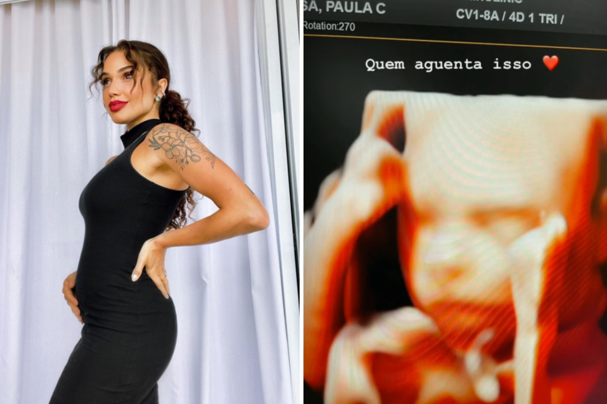 Paula Amorim mostra rostinho do filho em ultrassom 3D: "Quem aguenta"