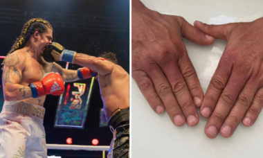 Após luta com Whindersson, Popó mostra mãos machucadas: "Não foi só você"