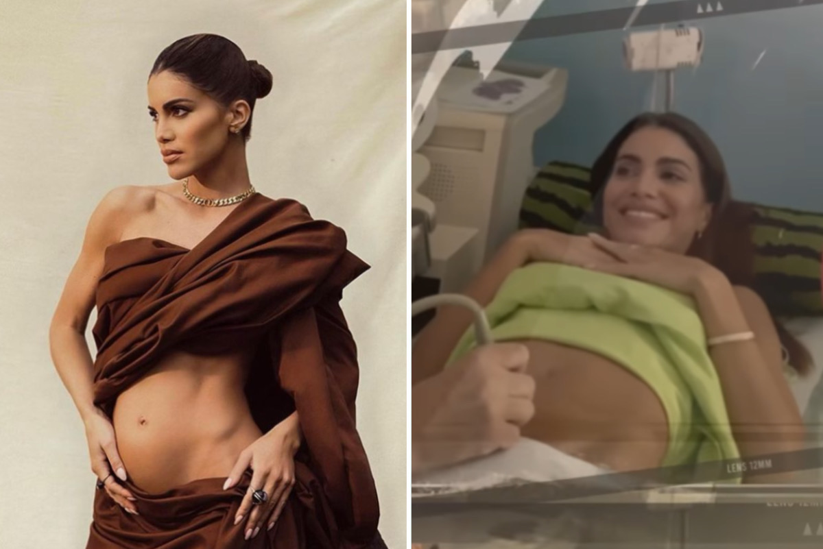 Grávida pela primeira vez, Camila Coelho mostra ultrassom