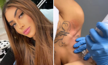 Mirella remove tatuagem com rosto do ex-marido, Dynho Alves
