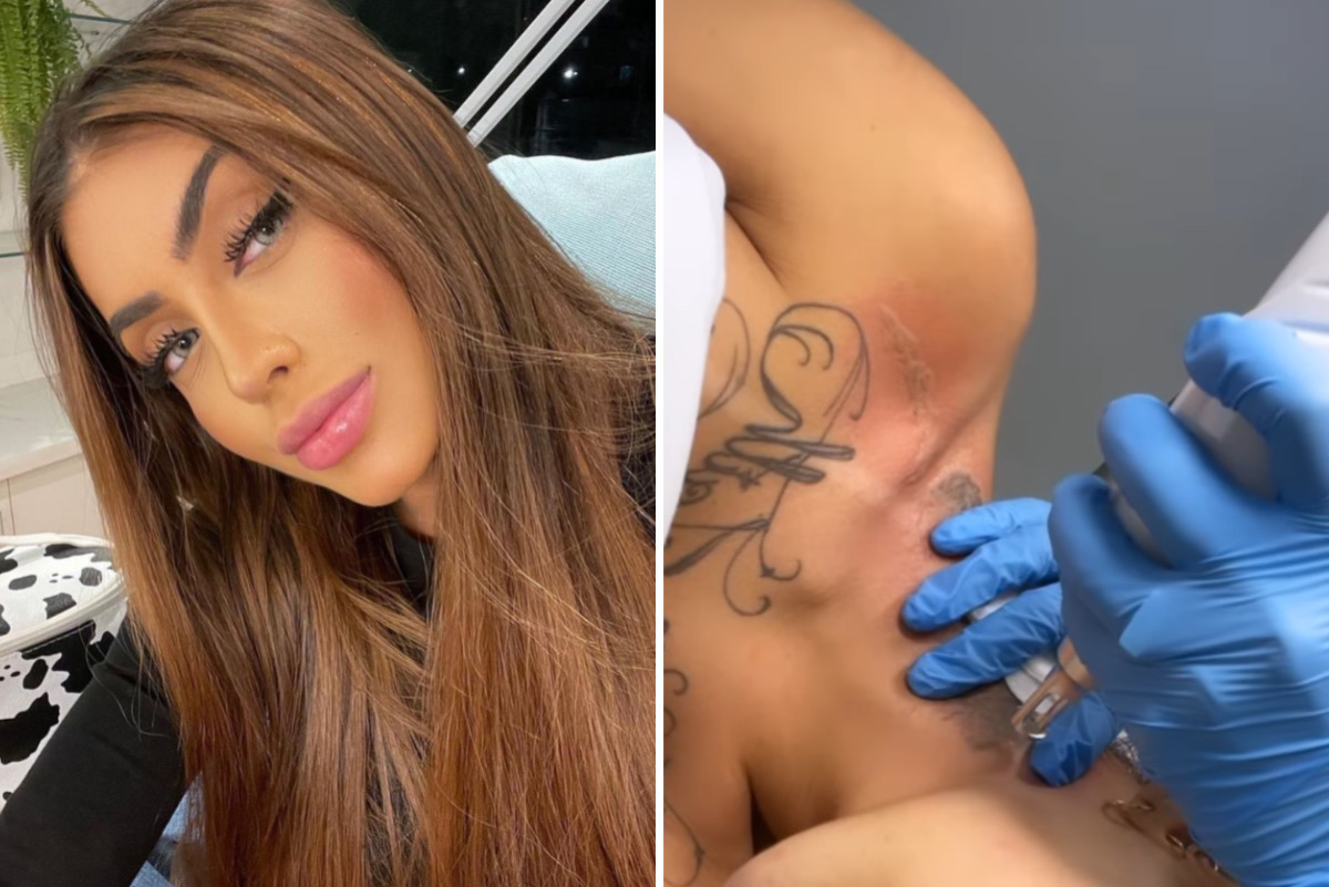 Mirella remove tatuagem com rosto do ex-marido, Dynho Alves