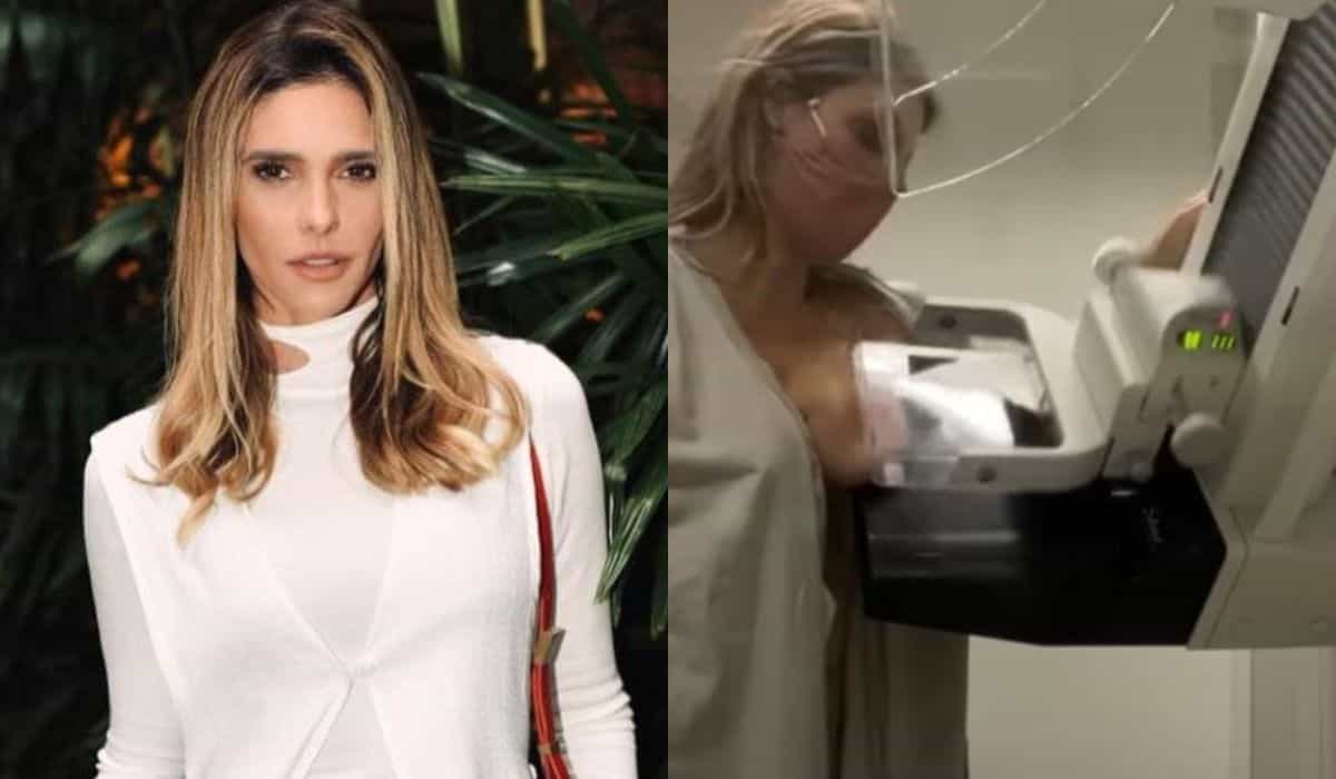 Fernanda Lima exibe mamografia e alerta: 'se cuidem mulheres'