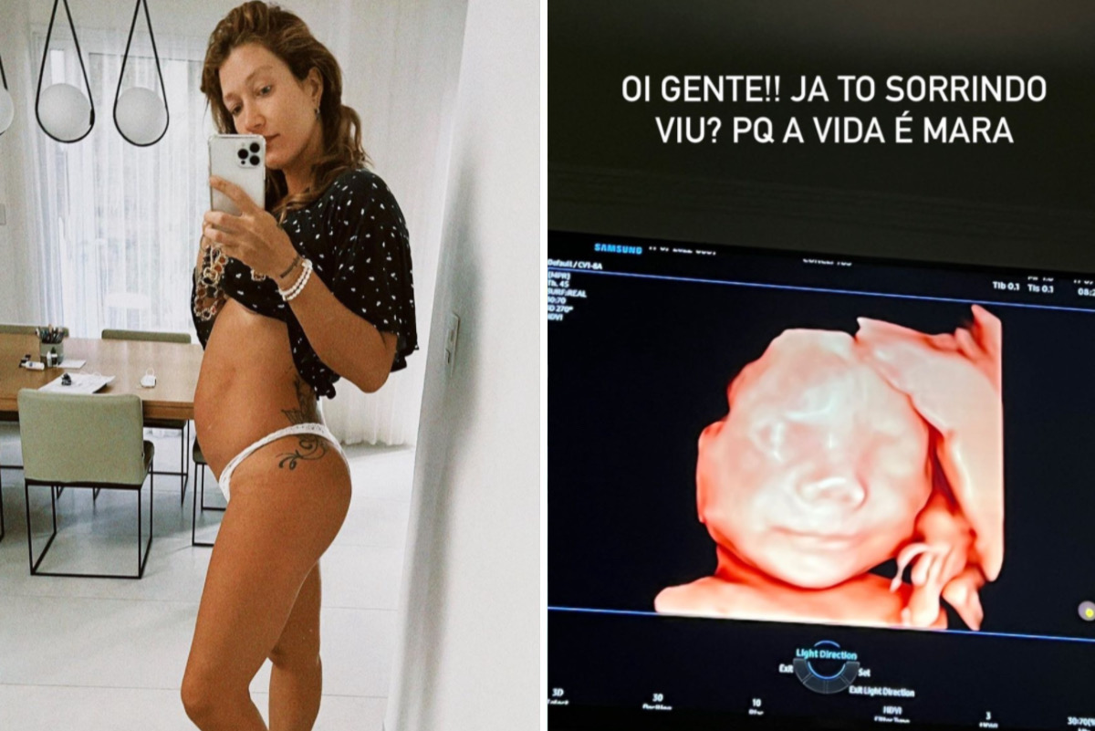 Gabriela Pugliesi mostra rostinho do filho em novo ultrassom: "Grande e bochechudo"