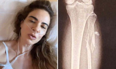 Luciana Gimenez recebe alta do hospital após quebrar a perna em acidente nos EUA