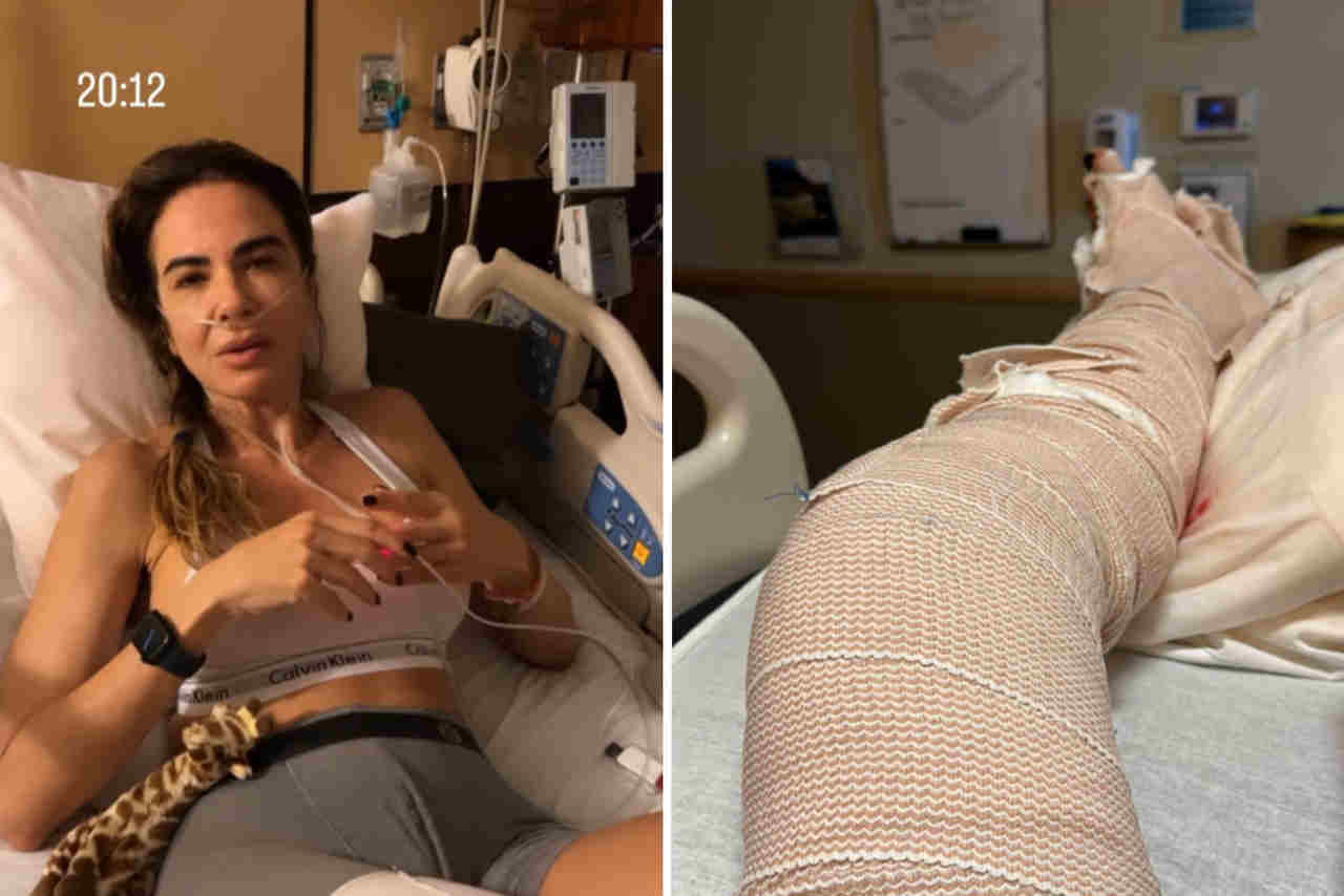 Luciana Gimenez atualiza fãs após quebrar a perna em acidente: "Muita dor"