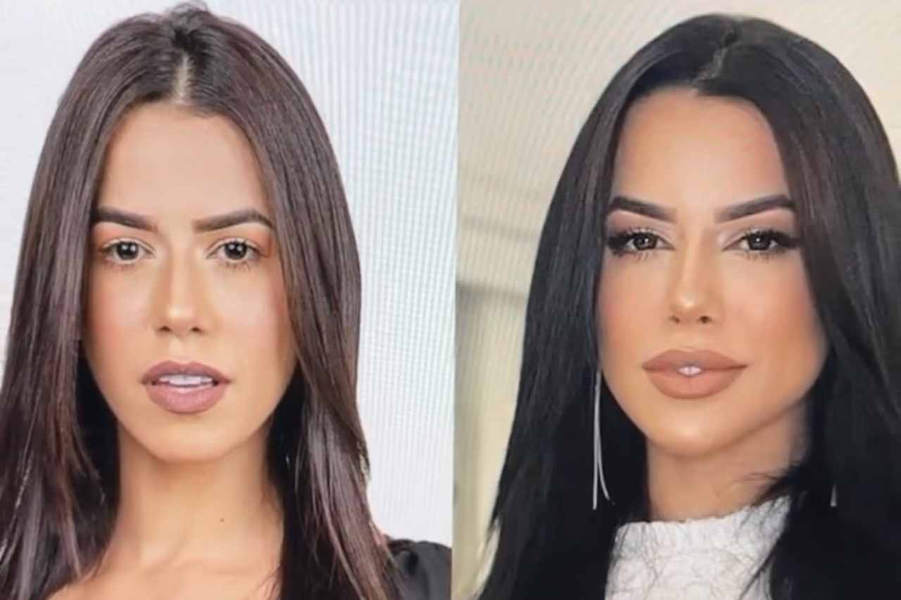 Ex-BBB Larissa Tomásia surpreende com antes e depois de harmonização facial