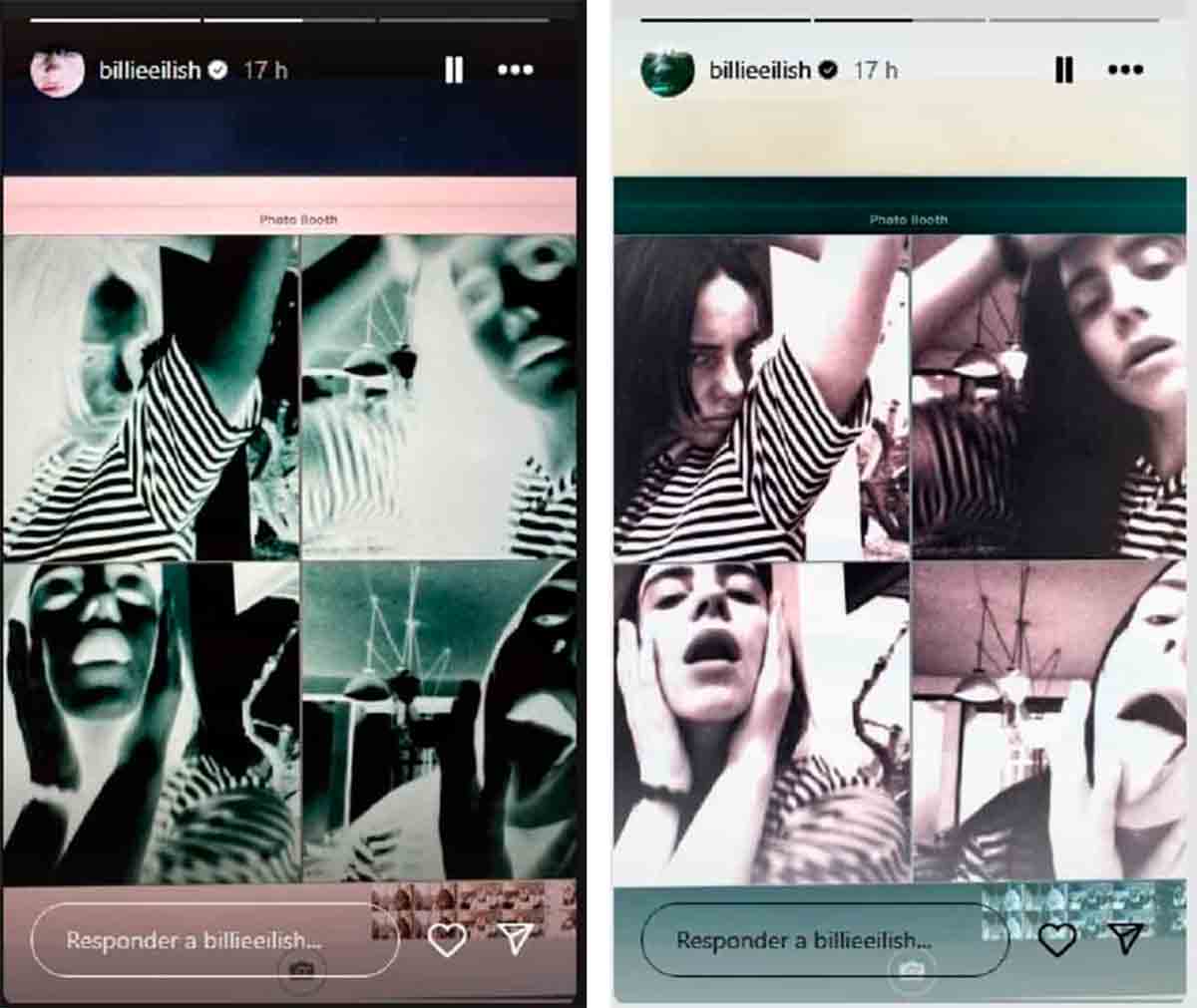 Billie Eilish divierte a los fans y rompe internet con fotos al estilo 'rayos X' en una pose extraña (Instagram / @billieeilish)