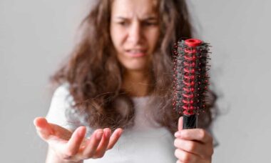 Dermatologista alerta sobre sinais preocupantes de queda de cabelo