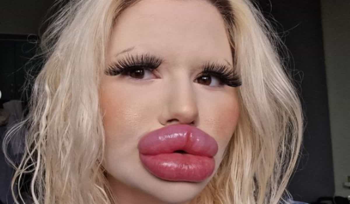 Influenceuse propriétaire des 'plus grandes lèvres du monde' reçoit des avertissements médicaux mais planifie de nouvelles interventions (Instagram / @andrea88476)