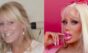 “Barbie humana” mostra antes e depois de gastar US$ 126 mil em cirurgias plásticas