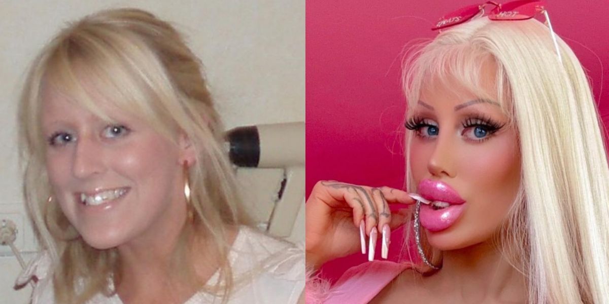 La 'Barbie humaine' montre avant et après avoir dépensé 126 000 USD en chirurgie plastique
