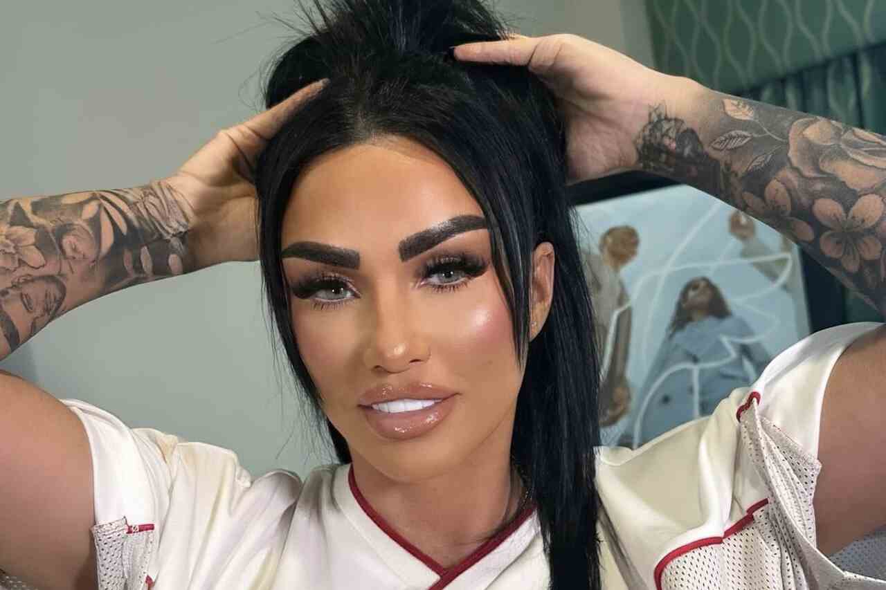 La mannequin anglaise révèle le résultat de sa dix-septième chirurgie plastique