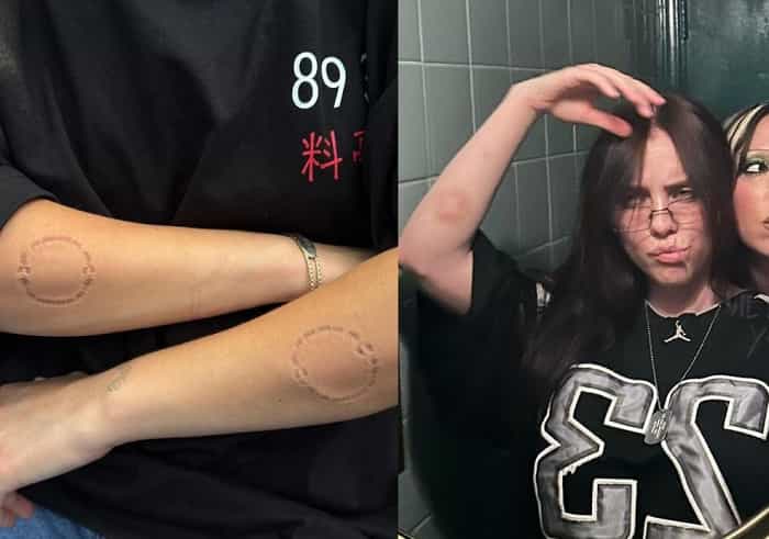 Billie Eilish bekymrer fansene ved at vise bidemærker og blå mærker i nye billeder (Instagram / @billieeilish)