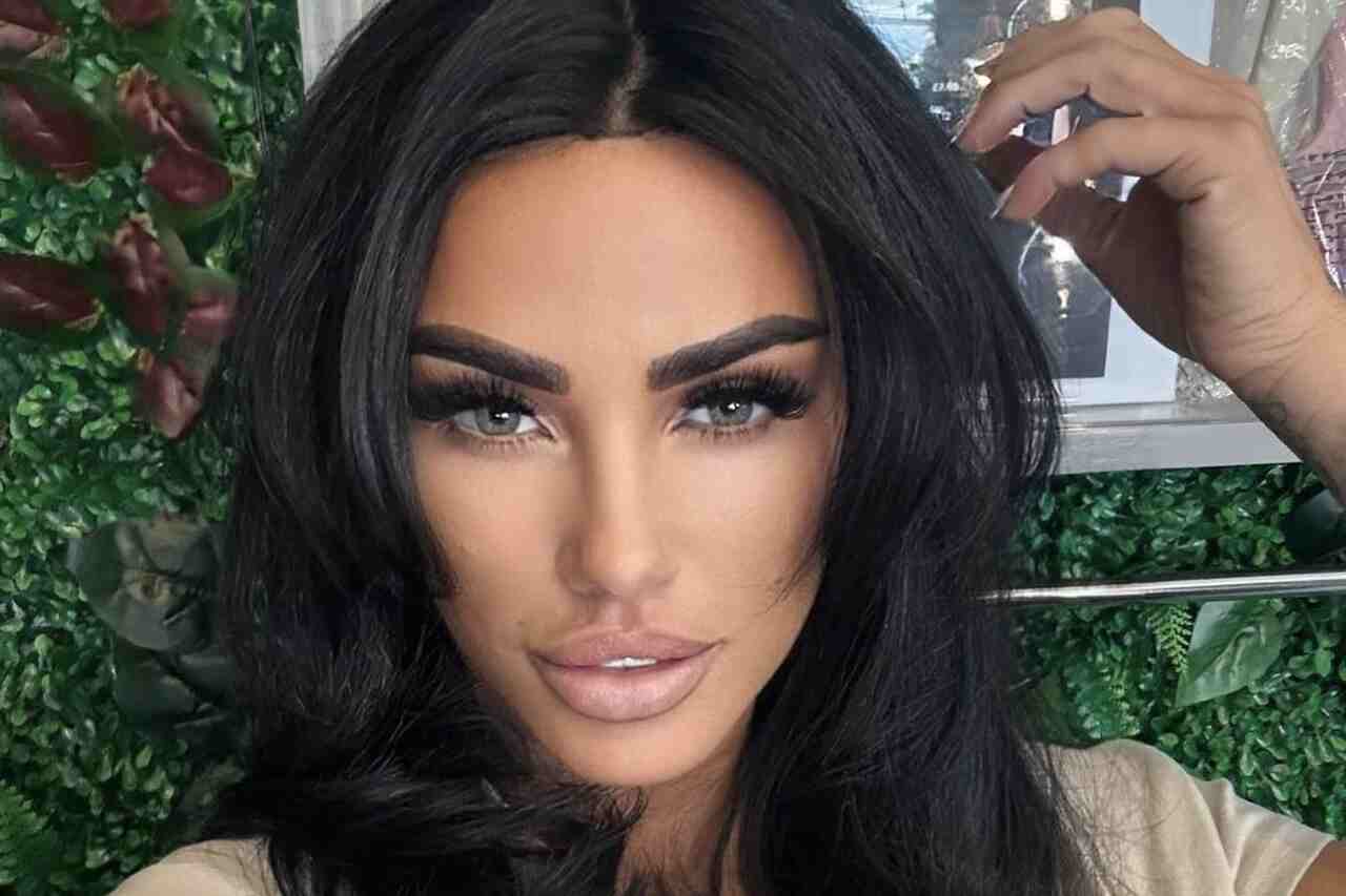 English model shows 'new face' after $13,000 transformation in Turkey