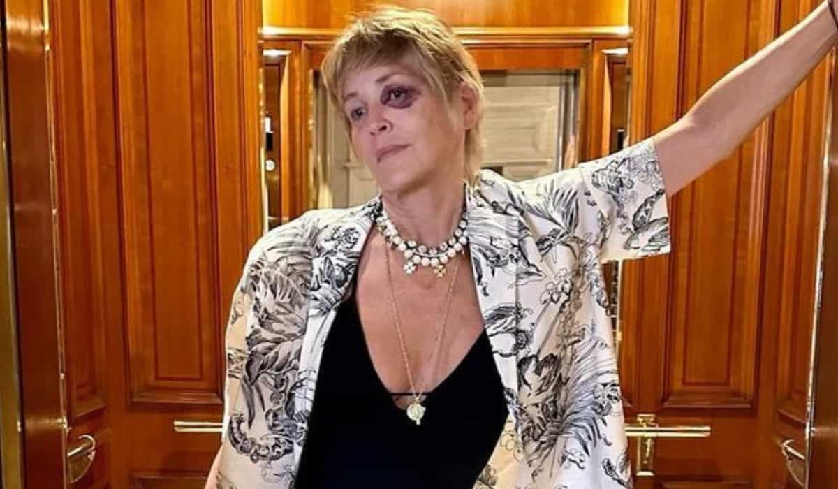 Sharon Stone bekymrer fans efter at have poseret med blåt øje under en rejse i Tyrkiet (Instagram / @sharonstone)