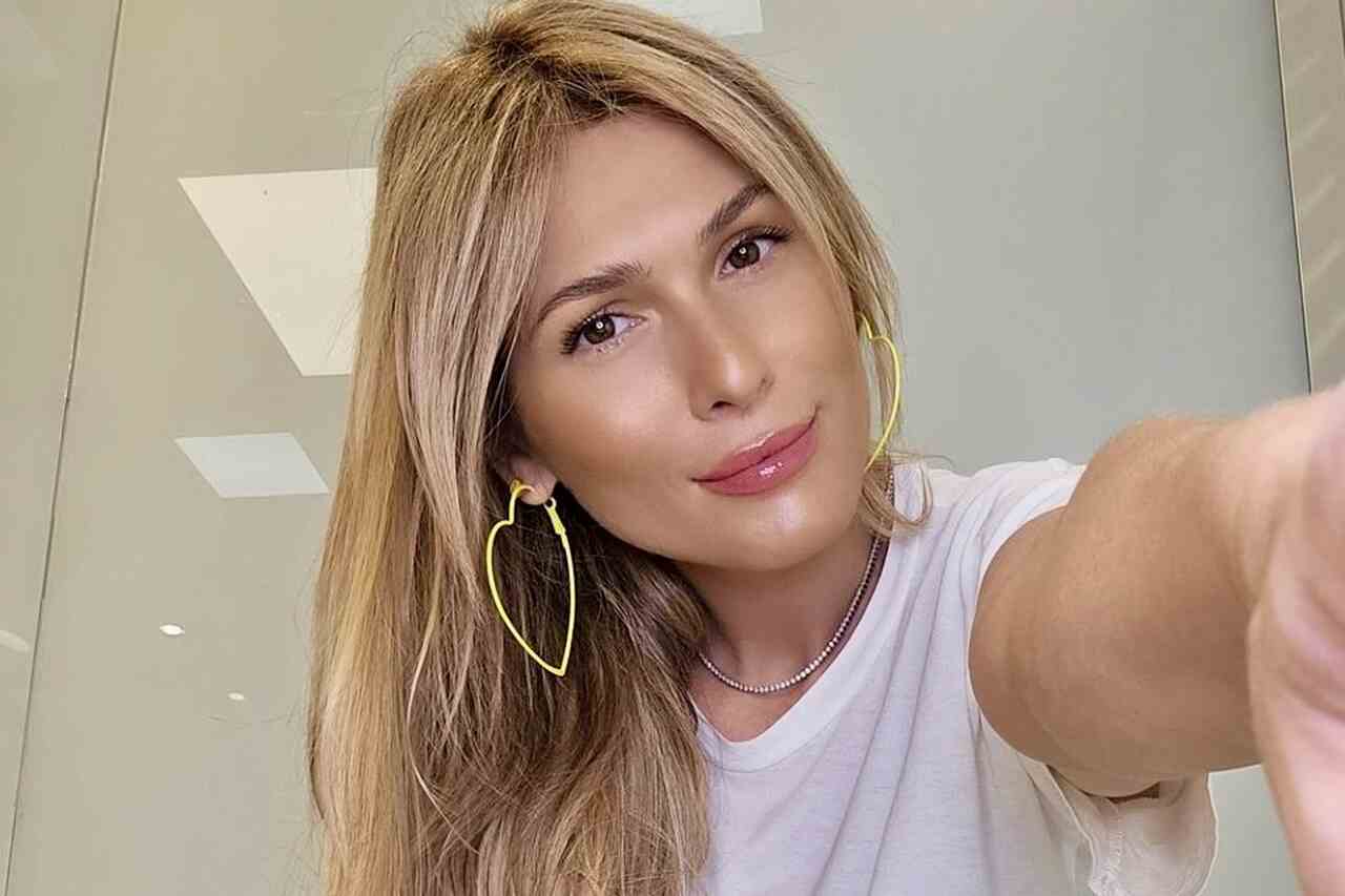 Brazilian presenter surprises after revealing liposuction results: “Shocked”